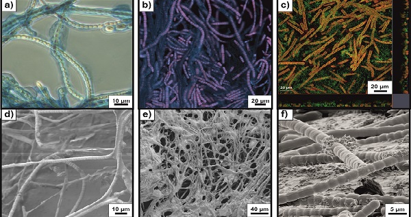 Different imaging techniques applied to biofilms consisting of Tolypotrix sp.
and P. taiwanensis (&copy; Mahir Bozan / UFZ)